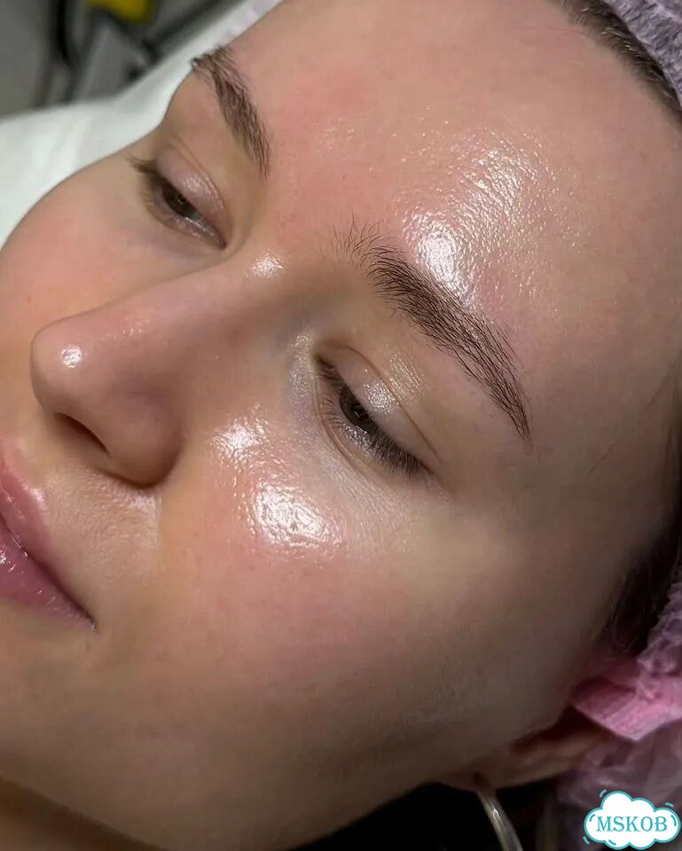 Косметолог чистка лица фото 4