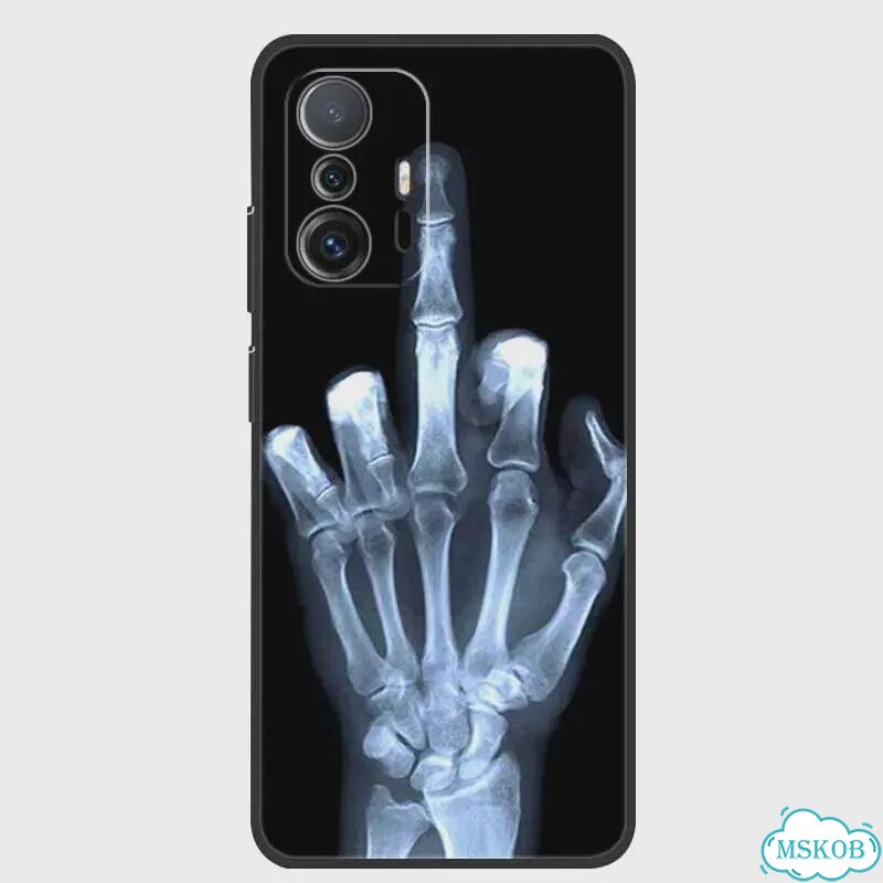 Для Xiaomi 11T Pro чехол животные защитный мягкий силиконовый Черный, G08.CH.443, For Xiaomi 11T Pro фото 4