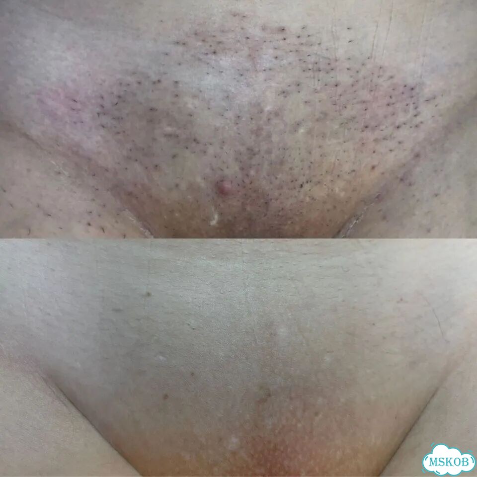 Абонементы -50% с 10 по 17 июля Лазер Жулебино фото 6