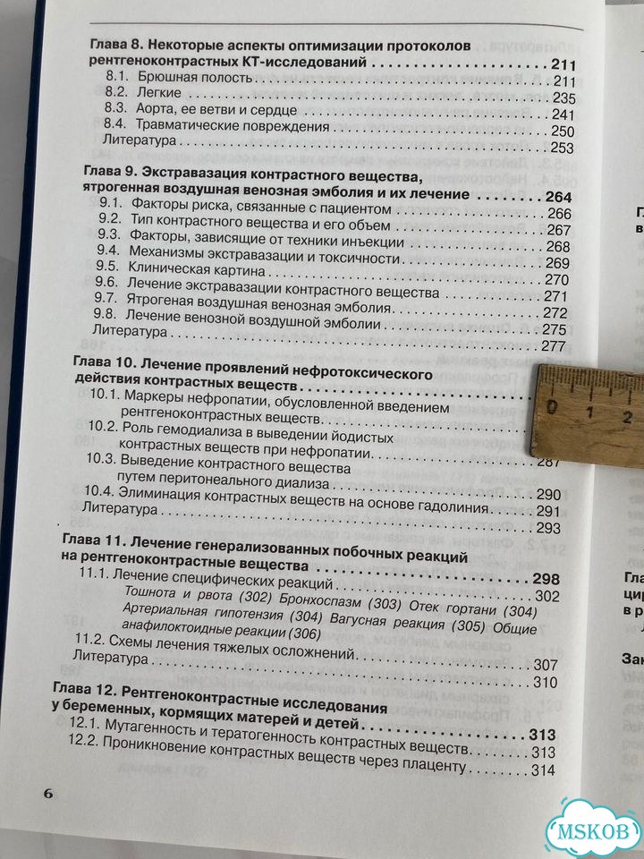 Спиральная компьютерная томография: болюсное фото 8