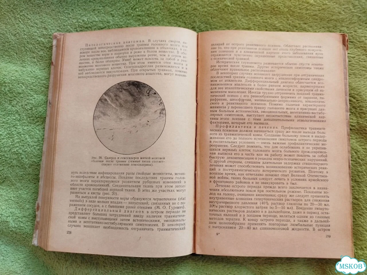 Психиатрия Случевский 1957 книга медицина фото 3